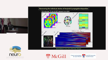 Multifactorial Brain Models for Understanding Neurodegenerative Progression - Prof. Y Iturria-Medina