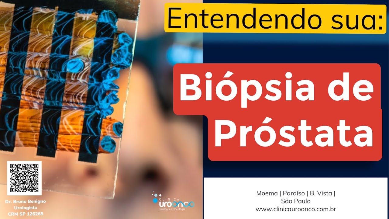 biopsia prostata positiva