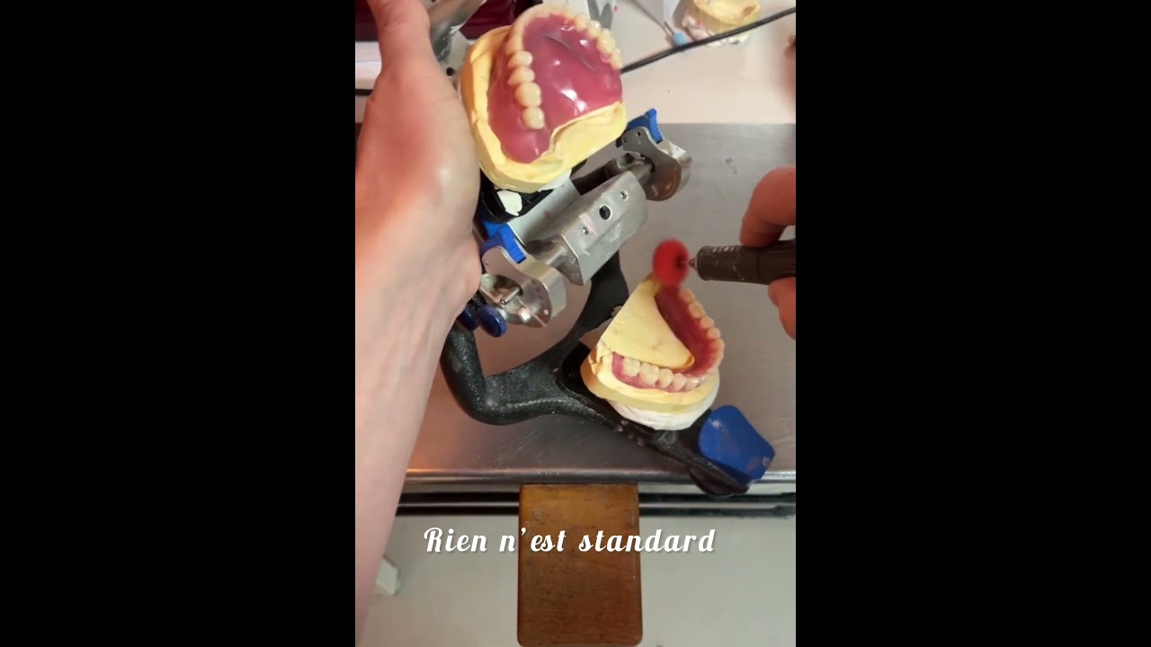 Chaque sourire est unique et m&eacute;rite un travail sur mesure.