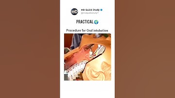 Procedure of Oral Intubation Practical | Science in Real 🌍 Life 3D Animation #intubation #practical