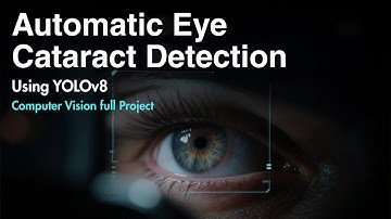 Automatic Eye Cataract Detection Using YOLOv8 | Computer Vision Project