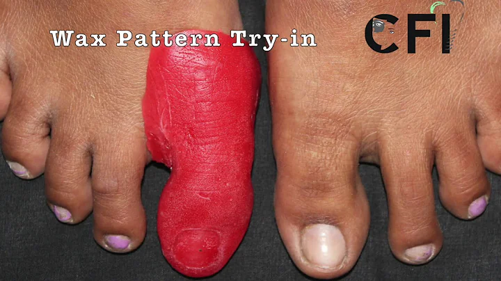 Toe prosthesis 1#Maxillofacial Prosthesis#Anaplastology#CFI