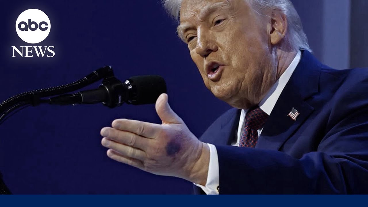 Trump says medical evaluation checked out perfectly' amid Iran tensions