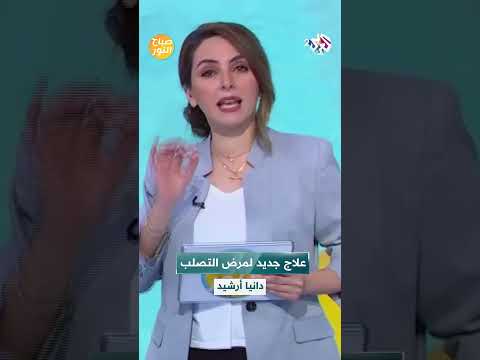 علاج جديد لمرض التصلب الجانبي الضموري