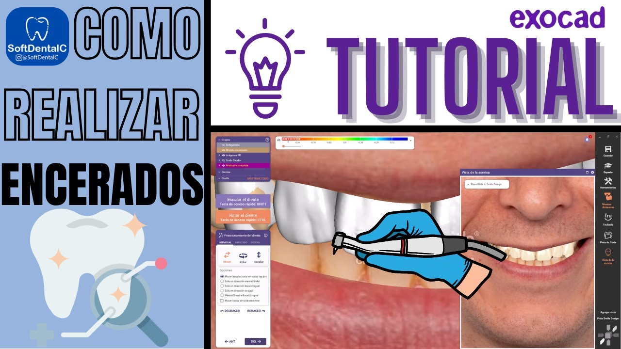 COMO REALIZAR ENCERADOS EN #EXOCAD 🔥¡TUTORIAL SOFTDENTALC!