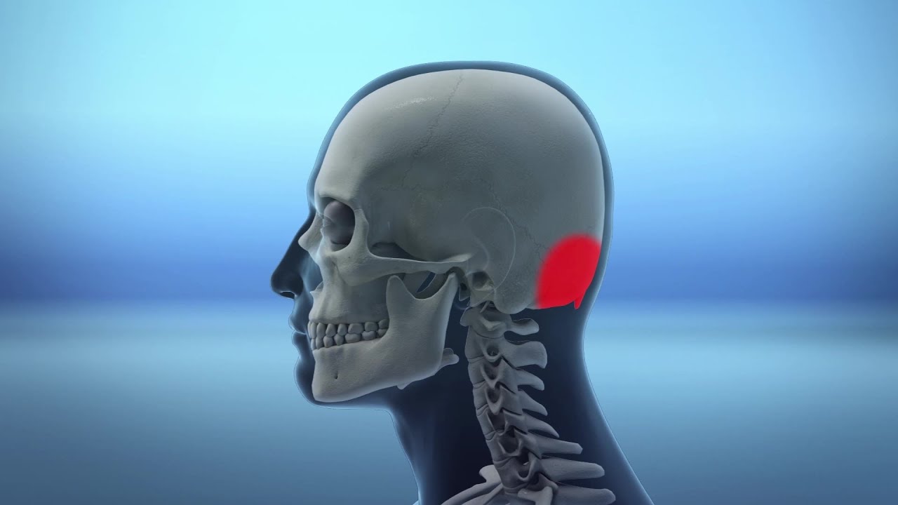 Poor Posture Due To Smartphone Use Leads To Horn Bone Growth In Skull Youtube