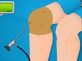 Operate now  knee surgery  play surgery games