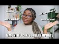 The TRUTH about LASIK EYE SURGERY | 6 Month Update