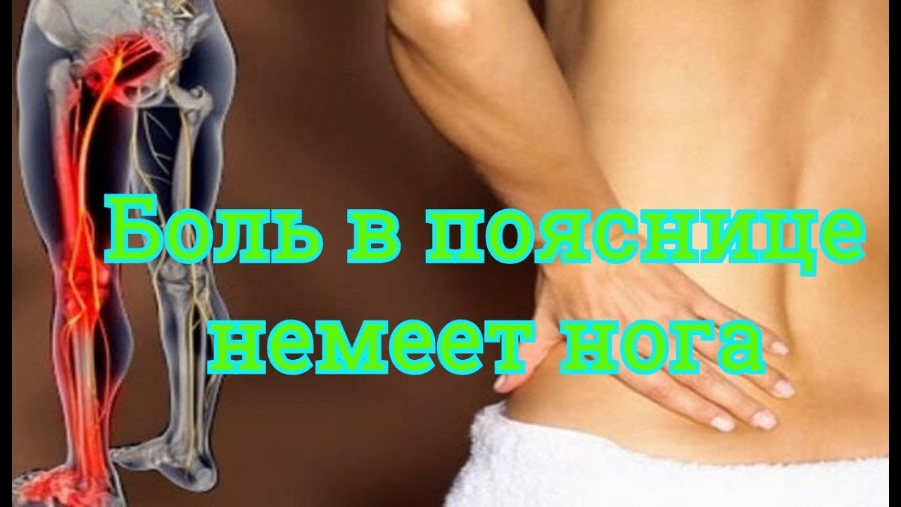 Болит поясница, отдает в ягодицу и ногу Точки для снятия боли в пояснице