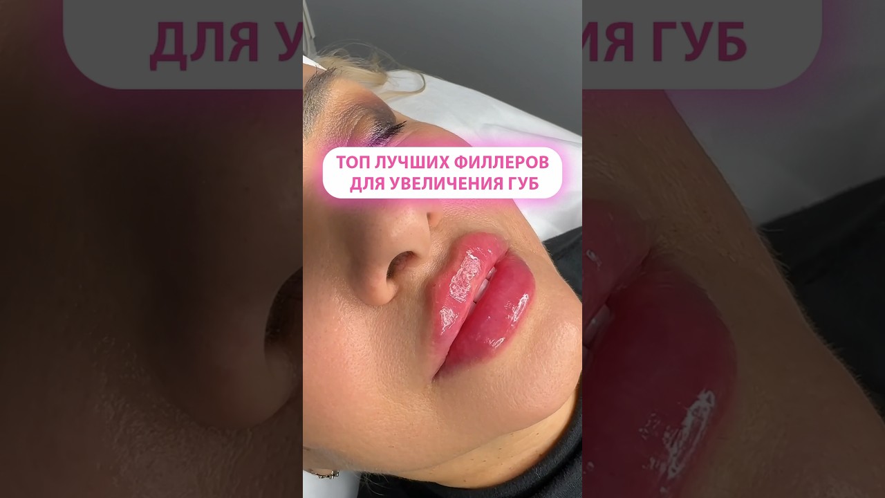 Лучшие филлеры для увеличения губ 👄