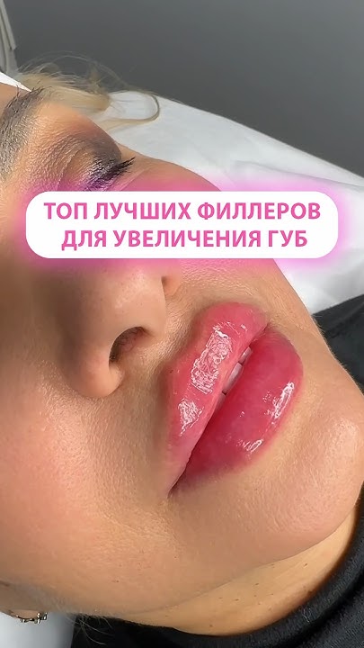 Лучшие филлеры для увеличения губ 👄 - YouTube