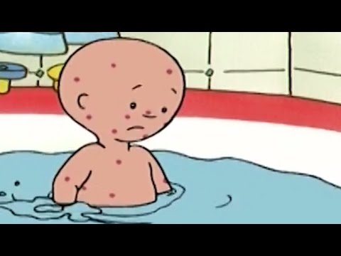 Caillou Türkçe HD - Caillou Hasta | Caillou Yeni Bölüm 2016 | kayu cizgi filmi