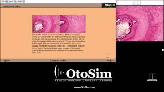 耳鏡訓練模擬 OtoSim™ Software Tour screenshot 3