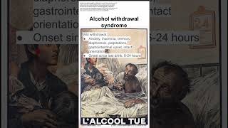 Alcohol withdrawal syndrome