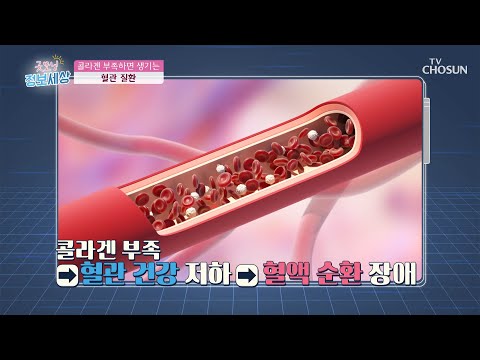 혈관 질환 가속화 시키는 ˹콜라겐 부족 현상˼ [굿모닝 정보세상] 230회  20200625