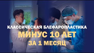 Круговая блефаропластика: тяжелые веки больше не тянут вниз!