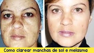 Receita Caseira Para Clarear Manchas de Sol na Pele