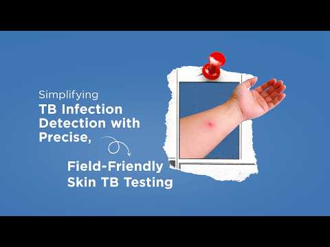 Why Precision Matters in TB Infection Detection | Simplifying with TB Skin Test