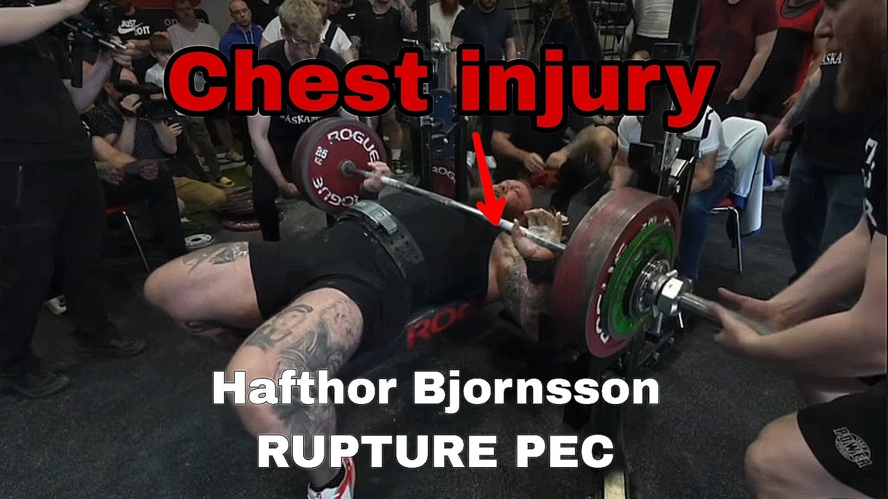 Hafthor Bjornsson RUPTURE PEC chest injury 2023 YouTube
