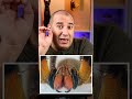 لو رأيت هذا الشيء في الموز ارميه فورا ولا تأكله 