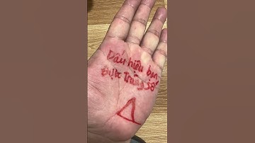 Chỉ tay trúng số