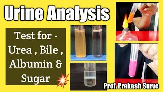 Urine Analysis for Normal and Abnormal constituents - ( Test for - Urea , Bile , Albumin & Sugar )