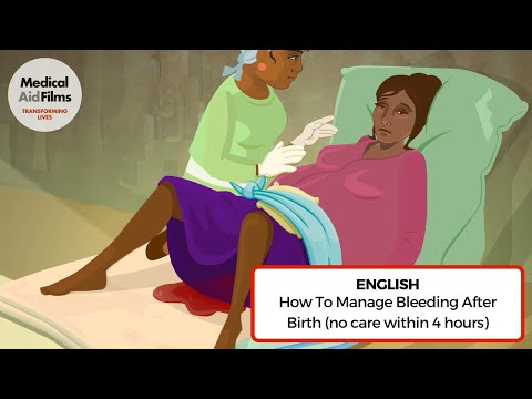 Video: How to Cope with Painful Ovulation: 10 Steps (with Pictures)