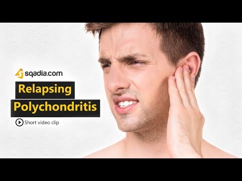 Relapsing Polychondritis | Rheumatology Medicine Animation | V-Learning | sqadia.com
