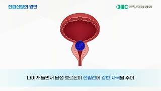 전립선암, 조기에 발견하려면? 증상과 진단법