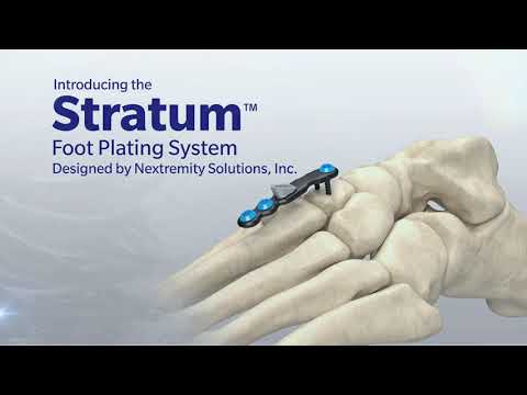 Stratum Foot Plating System