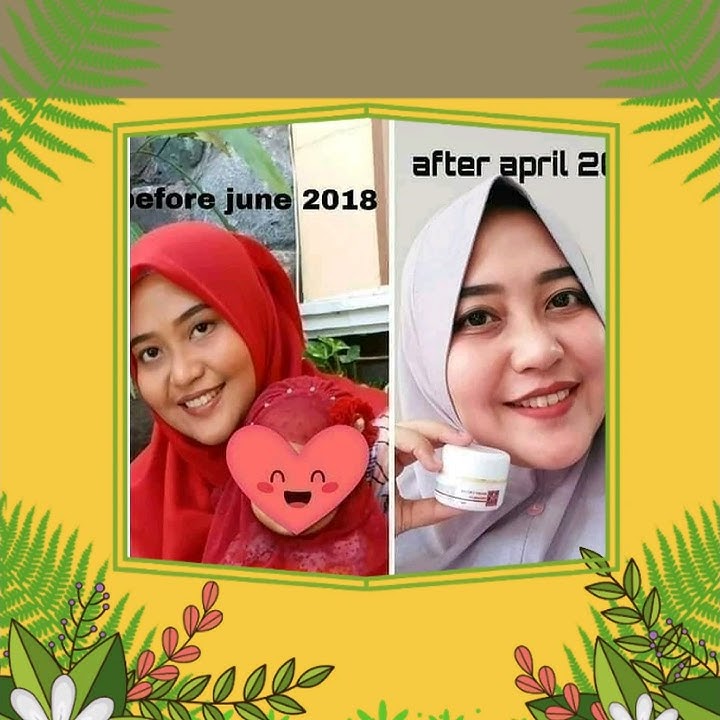 Cream pemutih wajah rk glow
