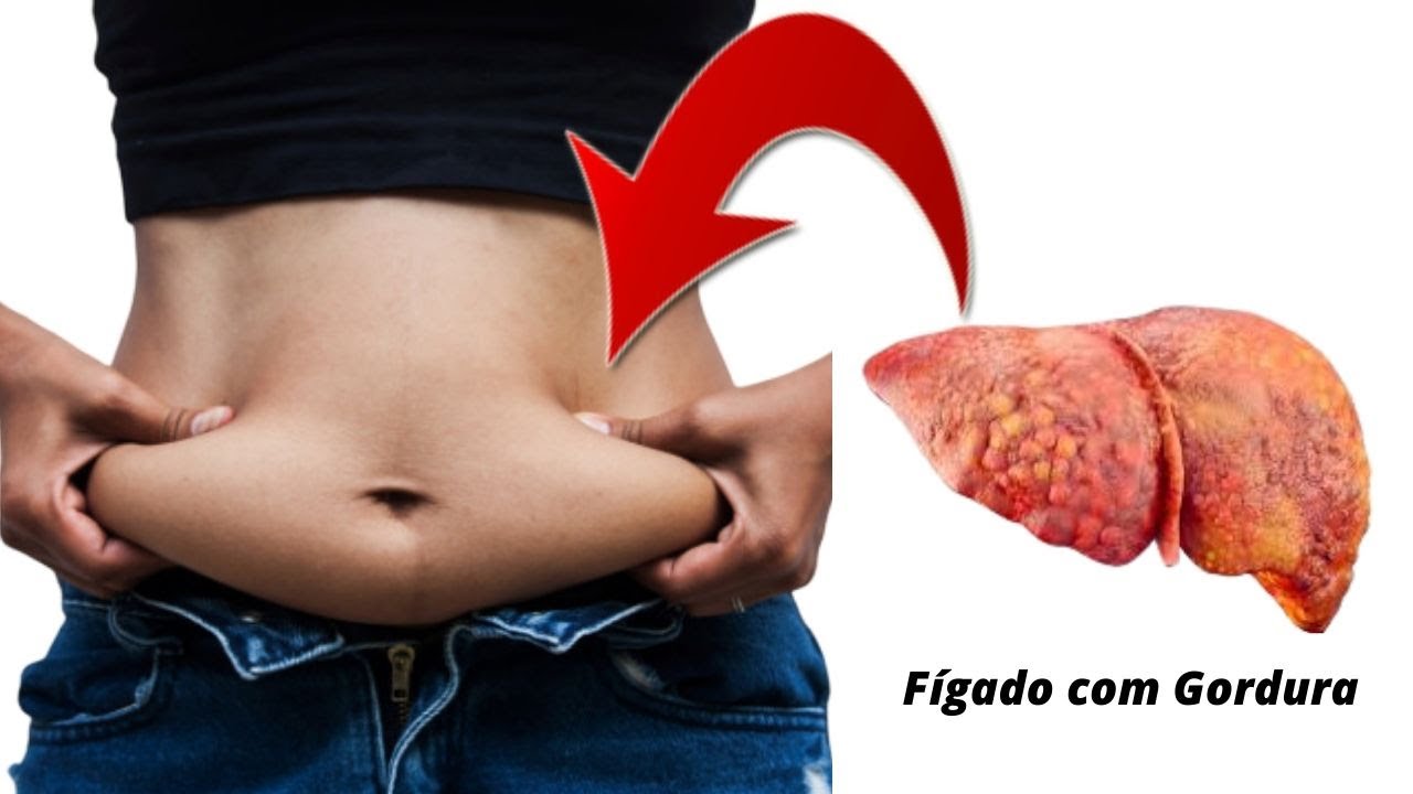 Como Eliminar Gordura No Figado Rapido