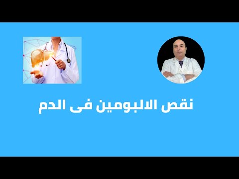 نقص الالبومين فى الدم بماذا يخبرك؟