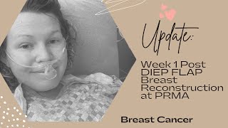 Update: One week Post DIEP Flap Breast Reconstruction