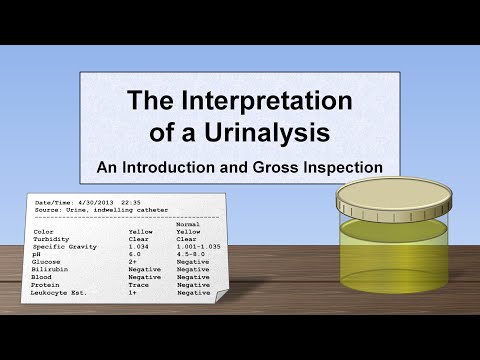 Video: General Urine Analysis: Norm And Interpretation Of Results