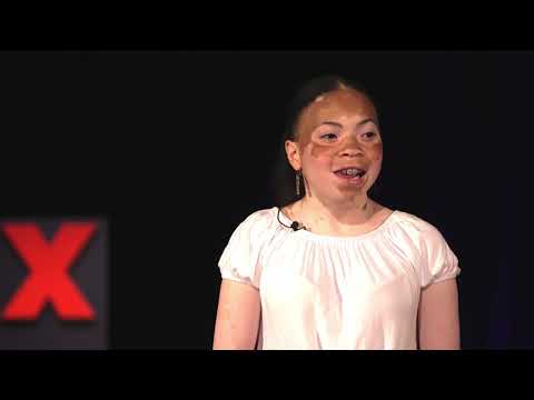 How Growing Up Looking Different Taught Me Compassion | Kayla Cooley Herndon | TEDxYouth@HCCS