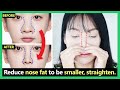 How to reduce big nose size, nose fat to small,slim,straight natural (new techniques & Best results)