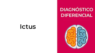 ¿Cuáles son otros diagnósticos diferenciales que puede imitar el ictus?