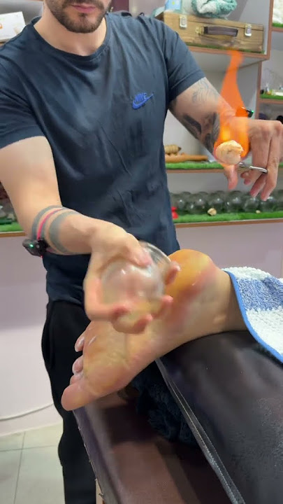 Her legs burned 😱#asmr #shorts #explore #massage #viral #cupping #youtubeshorts #fire