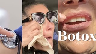 Dentist disaster , Emotional mess & Botox in my lips - lip flip