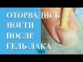 Трещина ногтя после наращивания. Отслойка ногтей.