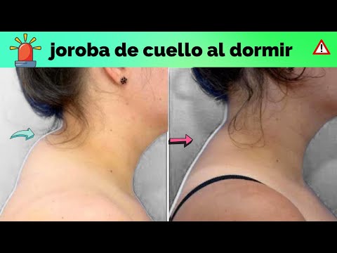 cómo quitar la JOROBA DE CUELLO MIENTRAS DUERMES