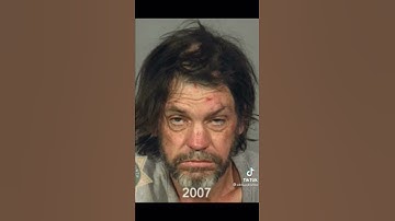 Meth use before and after #shorts #subscribe #shortscreator #2022
