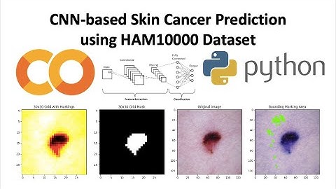 Skin Cancer Prediction using HAM10000 Dataset CNN-based EfficientNetB0
