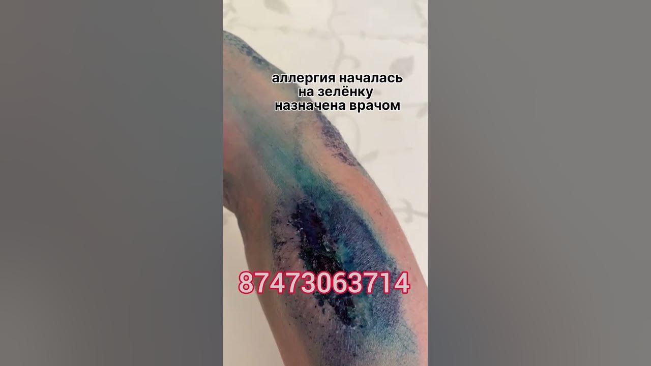 Женский гель глобал тренд нано бальзам результаты отзывы - YouTube