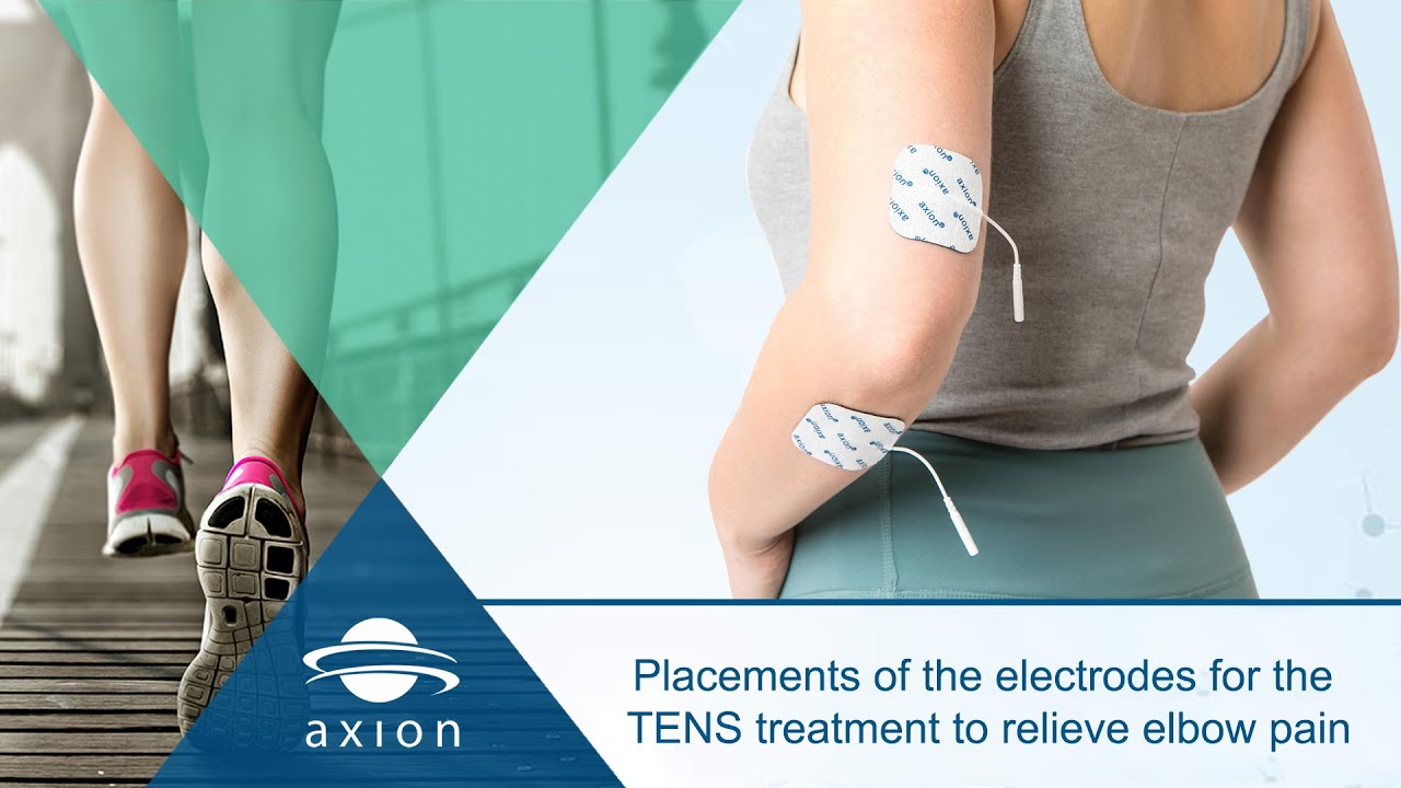 electrode placement for russian electrical stimulation for shoulder and  elbow - Yahoo Image Search Results