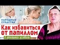 КАК ИЗБАВИТЬСЯ от ПАПИЛЛОМ в домашних условиях || народные средства