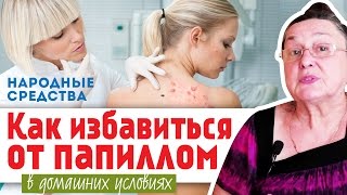 КАК ИЗБАВИТЬСЯ от ПАПИЛЛОМ в домашних условиях || народные средства КАК ИЗБАВИТЬСЯ от ПАПИЛЛОМ в домашних условиях || народные средства