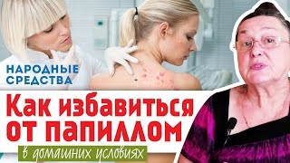 КАК ИЗБАВИТЬСЯ от ПАПИЛЛОМ в домашних условиях || народные средства(Как избавиться от папиллом народными средствами Как вывести папиллому народными средствами. Вполне естес..., 2016-06-26T06:52:58.000Z)