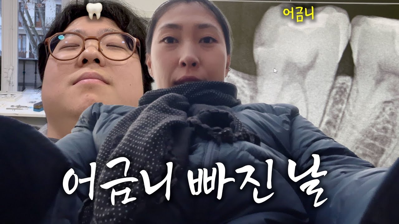 유럽 사워도우 단단하다… 치과 치료비 많이 들거야🦷 살다살다 어금니 박살 브이로그를 다 찍어보는 30대 이민자들